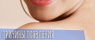 Что делать, если у женщины появились волосы на подбородке