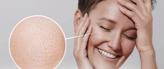 Домашние рецепты для сужения пор