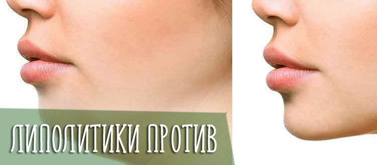 Эффективность использования липолитиков от второго подбородка