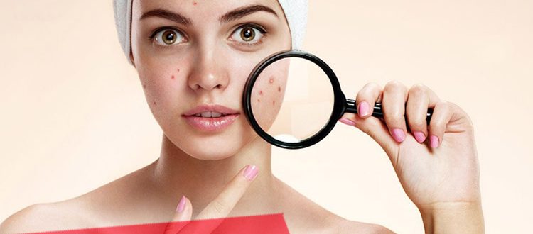 Как победить сыпь на лице – советы косметологов