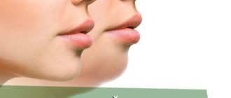 Как убрать второй подбородок с помощью инъекций
