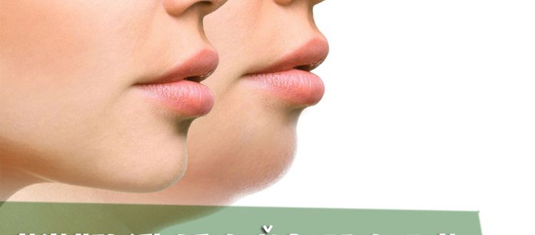 Как убрать второй подбородок с помощью инъекций