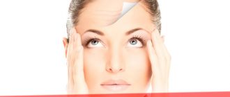 Когда показан ботокс в лоб и межбровье – отзывы с фотографиями