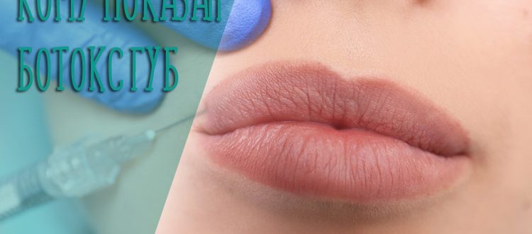 Кому показан ботокс губ – особенности процедуры и противопоказания