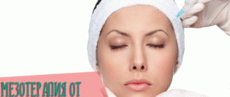Мезотерапия от мешков под глазами с фото до и после