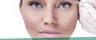 Неудачный ботокс - как минимизировать последствия
