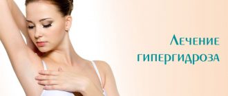 Особенности лечения гипергидроза ботоксом