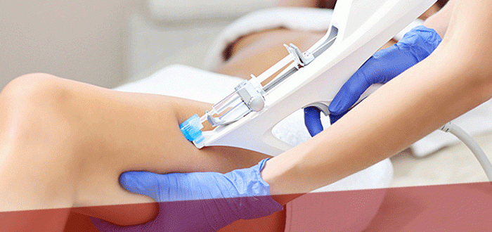 Особенности сосудистого этапа в мезотерапии