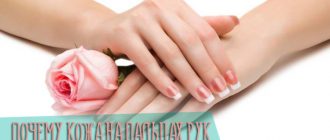 Почему кожа на пальцах рук шелушится и облазит - причины и следствия