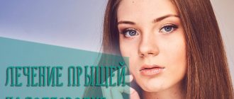 Причины и лечение прыщей на подбородке у девушек