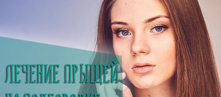 Причины и лечение прыщей на подбородке у девушек