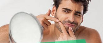 Причины появления прыщей на подбородке у мужчин, их лечение