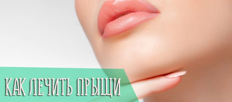 Прыщи на подбородке и шее у женщин и мужчин, причины и лечение подкожных прыщей