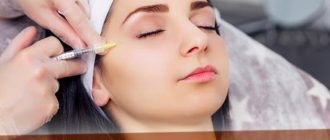 Сколько держится ботокс на лице