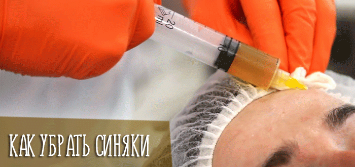 Советы косметологов, как быстро убрать синяки после мезотерапии