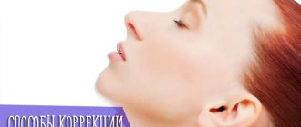 Способы коррекции второго подбородка