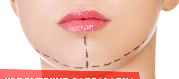 Всё, что вы должны знать перед тем, как проводить увеличение подбородка