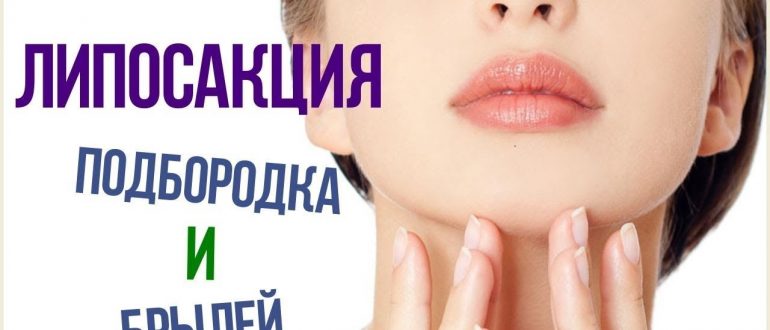 липосакции подбородка