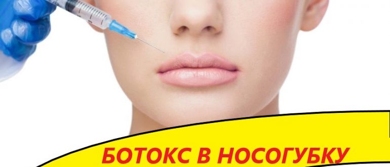 Ботокс в носогубные складки – отзывы с фото до и после
