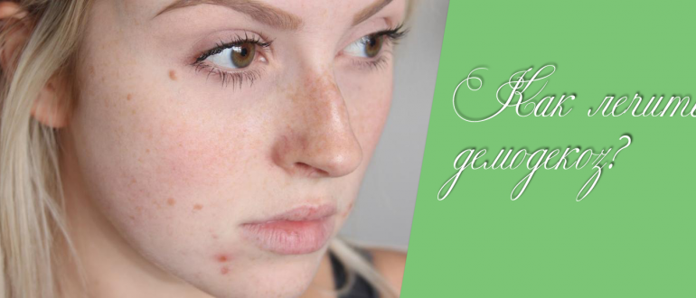 Демодекс на лице – правильное лечение, которое навсегда избавит вас от клеща