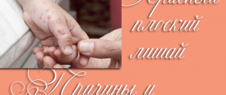 Красный плоский лишай у человека – фото, признаки и лечение