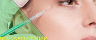 Неудачный ботокс - как минимизировать последствия
