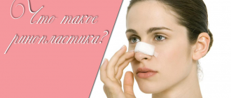 Ринопластика – что это такое?