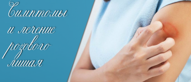 Розовый лишай у человека – симптомы и лечение