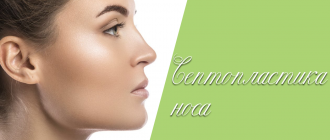 Септопластика носа – что это такое?