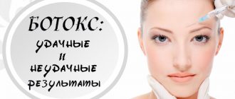 Удачные и неудачные фотографии до и после процедур ботокса