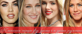 Звёзды до и после пластики – удачные и неудачные операции