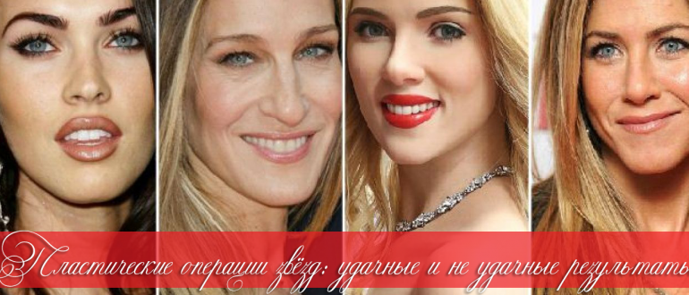 Звёзды до и после пластики – удачные и неудачные операции