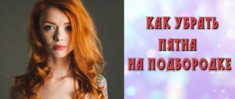 Почему на подбородке появляются красные пятна, которые шелушатся?