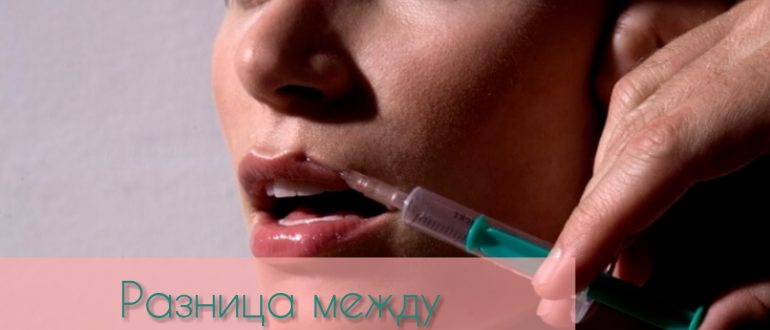 Филлер или ботокс – в чём разница препаратов?