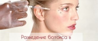 Как разводить ботокс для косметологии?