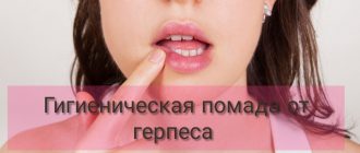 Гигиеническая помада от герпеса