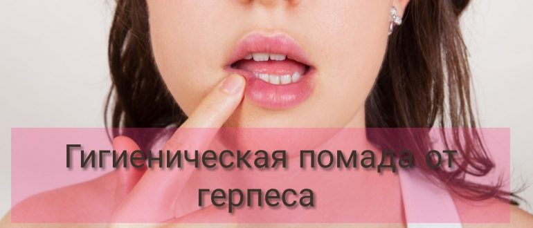 Гигиеническая помада от герпеса